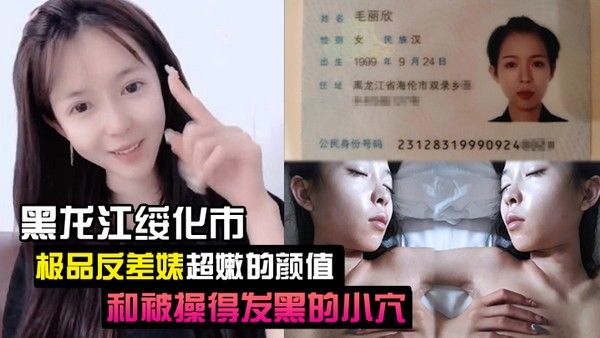 泄密流出黑龙江绥化市极品反差婊超嫩的颜值.和被操得发黑的小穴封面